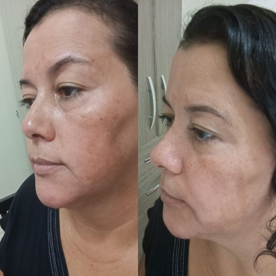 Post do instagram lançamento de creme moderno verde (2)