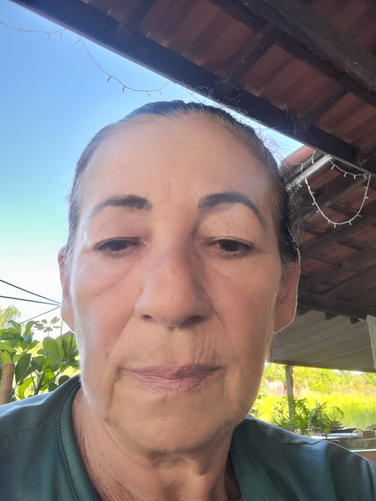Depois — Resultado 4